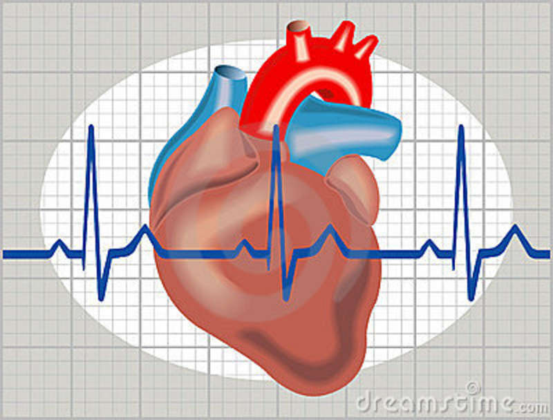 cardiac-arrhythmia-18864765