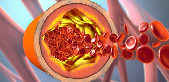 Hipertenzija kao čimbenik rizika za razvoj kardiovaskularnih bolesti